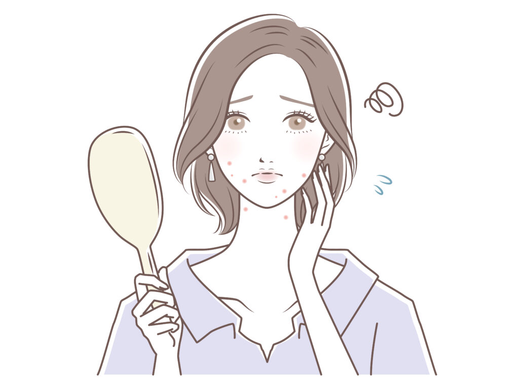 ニキビ治る？