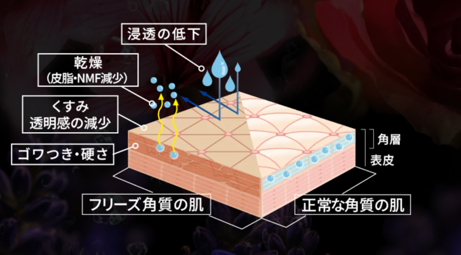 フリーズ角質